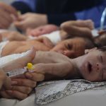 أطفال غزة يموتون ببطء تحت أنظار العالم.